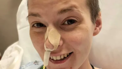 Donna Rivela di Avere la 'Malattia del Vampiro': Ecco di Che Cosa Si Tratta 2 Donna rivela di avere la 'malattia del vampiro