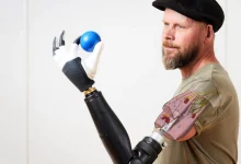 Il Futuro delle Protesi: Libertà di Movimento Grazie alla Tecnologia Avanzata! 38 Il Futuro delle Protesi: Libertà di Movimento Grazie alla Tecnologia Avanzata!